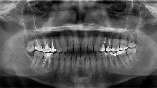 Radiografía panorámica dental